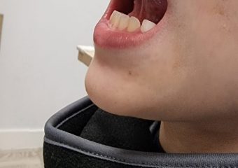 Motricidad orofacial